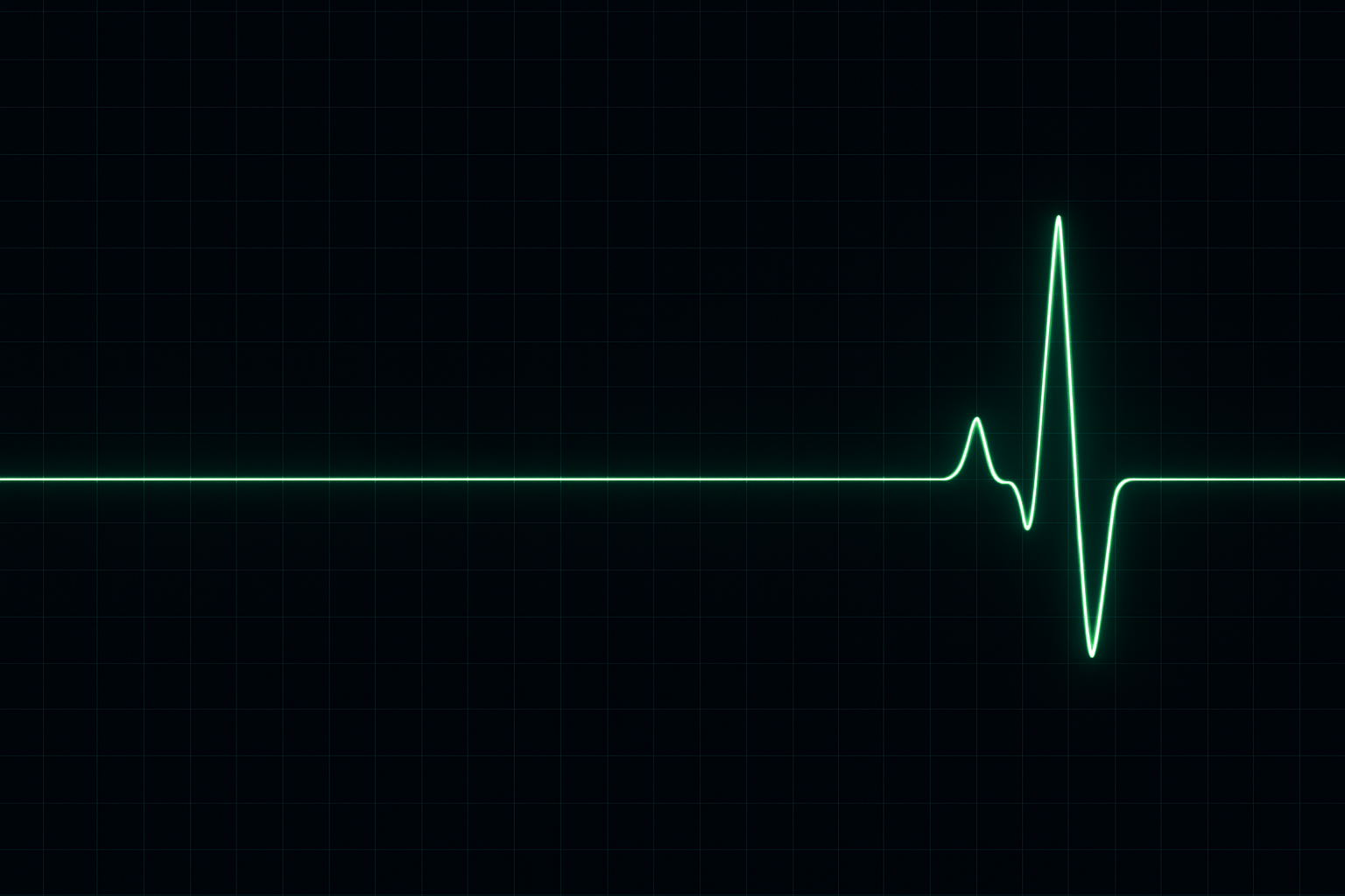 Has Your PLM system flatlined?